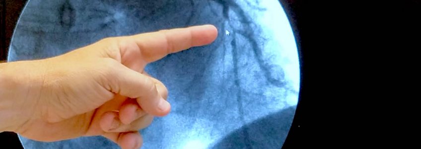 Puesta en marcha del Servicio de Hemodinamia y Cardiología Intervencionista